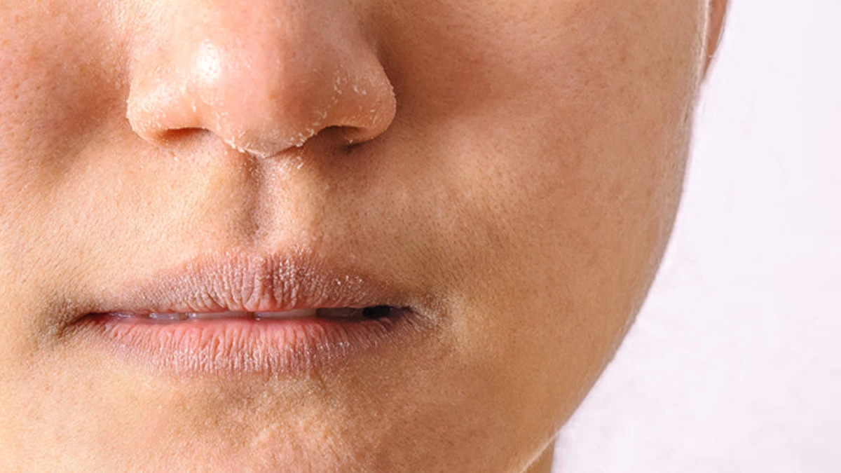 Causes of skin peeling on the nose