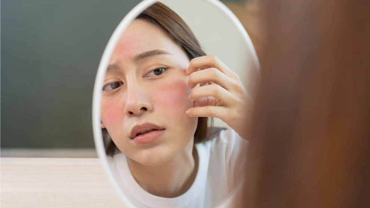 Why Does Facial Peeling Occur? Solutions and Remedies